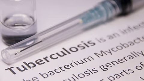 Breaking TB’s Grip: New Antibiotic Offers Fresh Hope Against the World’s Deadliest Curable Disease