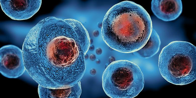 A Stroke of Genius: Stem Cell Treatment Offers Unprecedented Recovery Potential