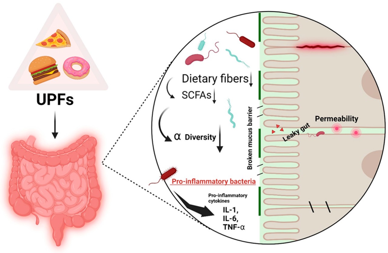 Gut Check: Ultra-Processed Foods Are Quietly Wrecking Your Microbiome