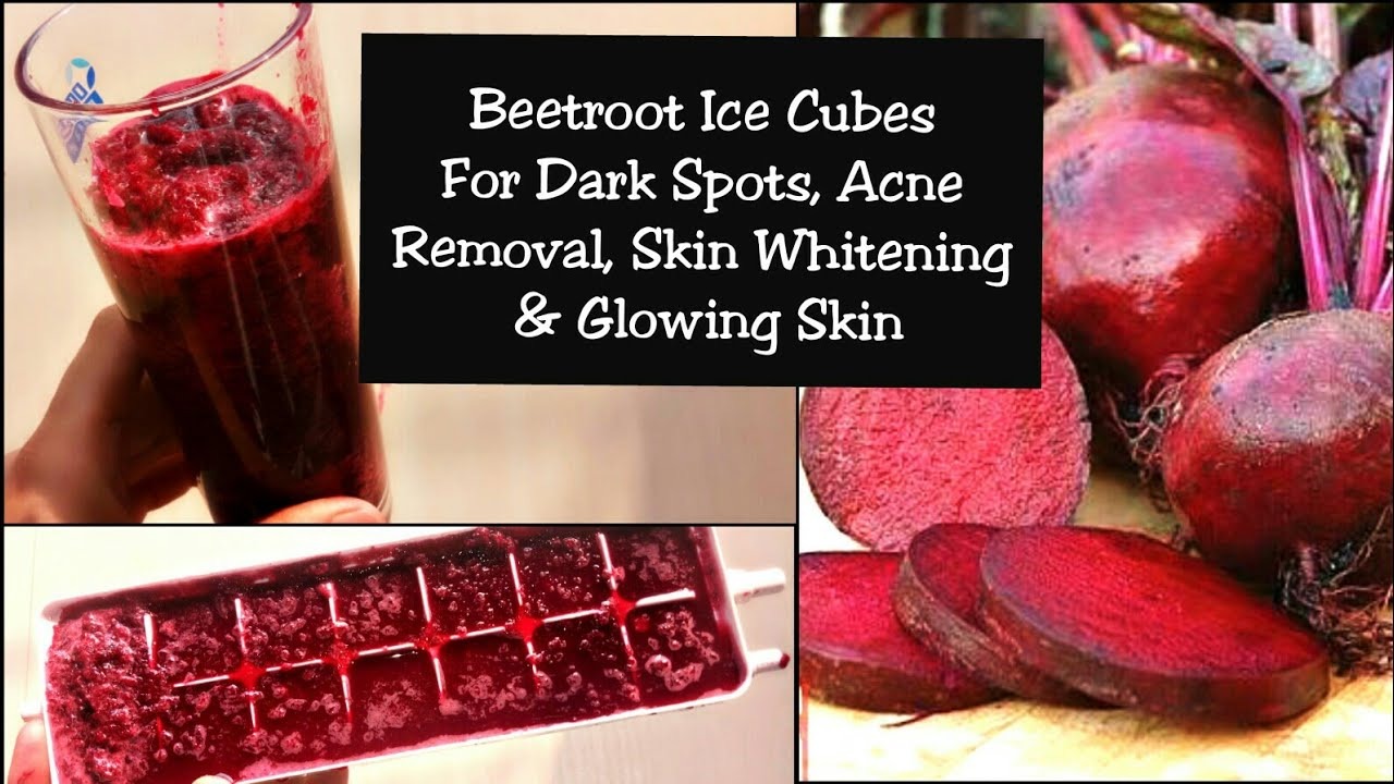 Freeze Your Way To Flawless Skin With These Simple Beetroot Ice Cube Recipes