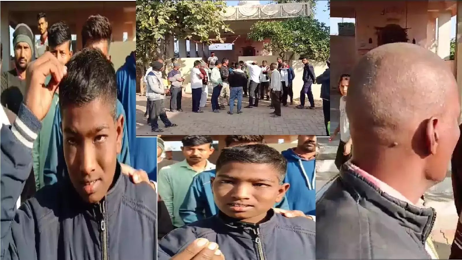 Maharashtra's 'Bald Virus': Shegaon Villages Face Unprecedented Hair Loss Crisis