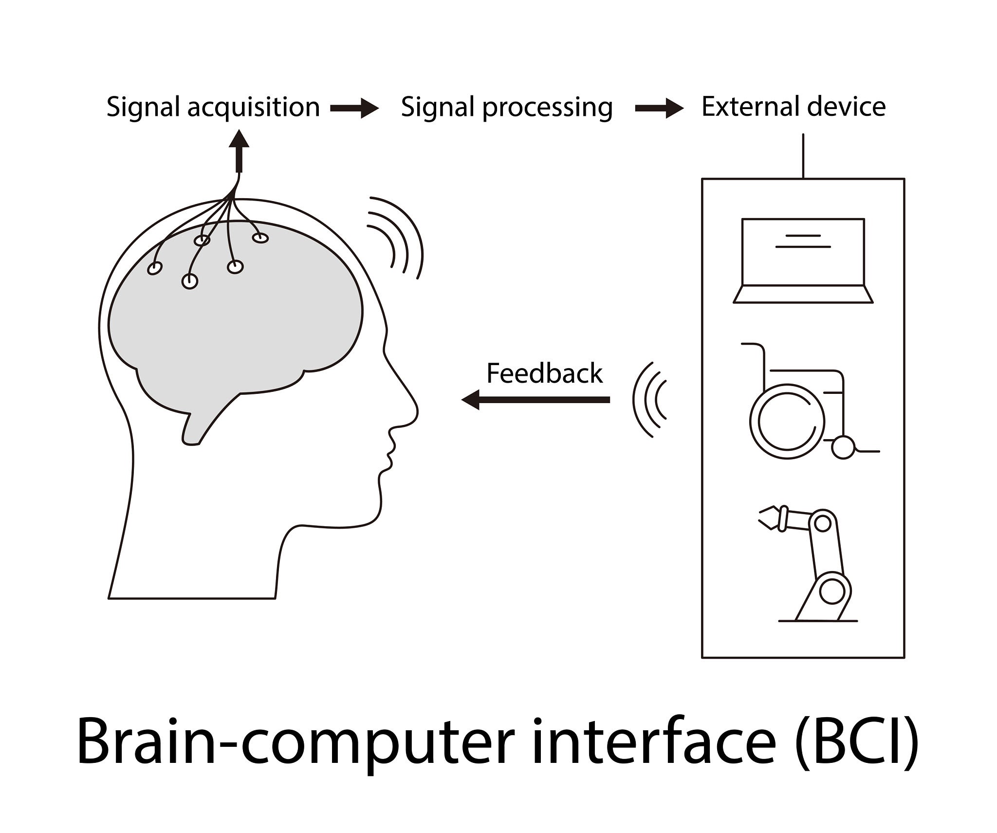 FDA Approves Expanded Clinical Trials for Neural Brain Implants