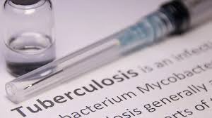 Smartphones Help Detect TB AI Boosts Rural Screening by 13%