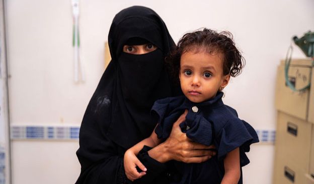 Yemen’s Food Security Crisis Deepens Amid Economic Collapse