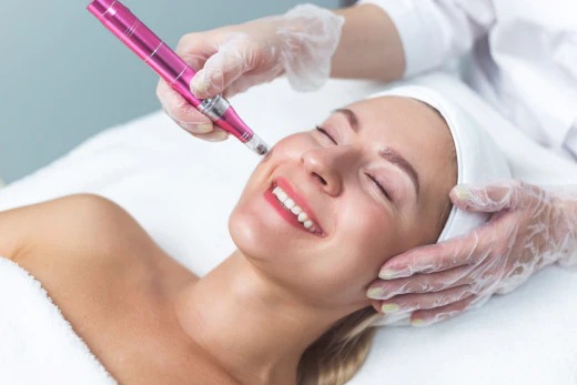 Microneedling: The Skin Rejuvenation Technique Gaining Traction