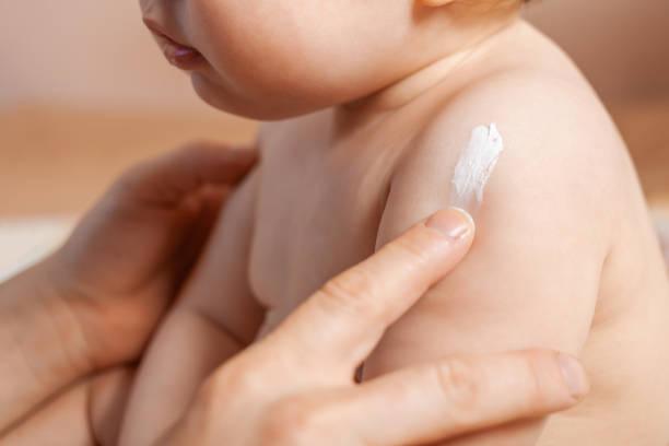 Monsoon Magic for Baby Skin: Dermat’s 5 Tips to Keep Rashes at Bay