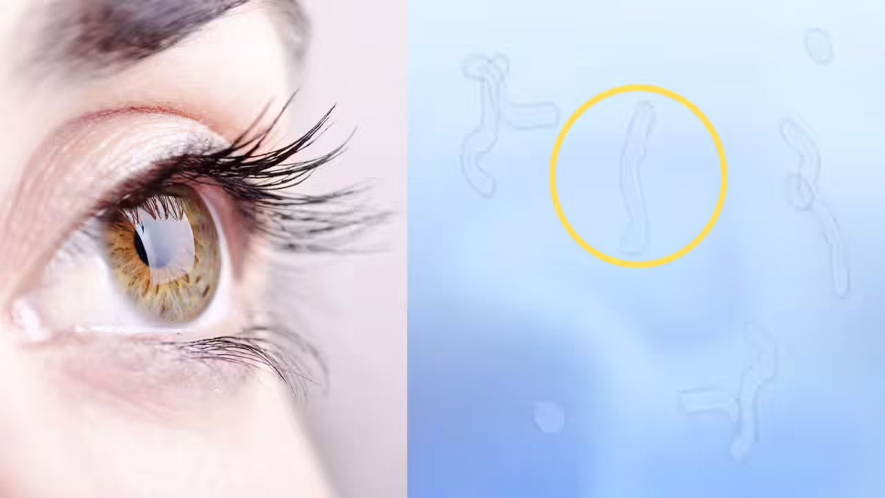 Spot the Warning: Why Those Floating Dots in Your Vision Might Be More Than Just Stress