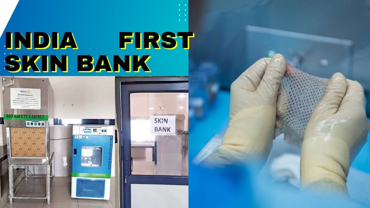 Kerala to Inaugurate First Skin Bank in Thiruvananthapuram
