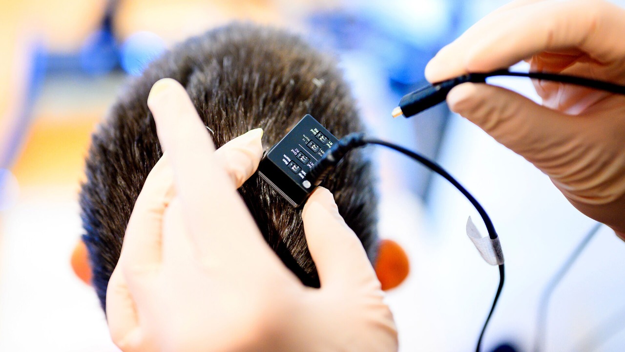 Lost Voice, Found Again: The Thrilling Story of Real-Time Speech via Brain Interface