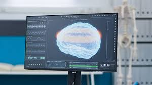 IIT Madras Unveils 3D Atlas of Human Brainstem