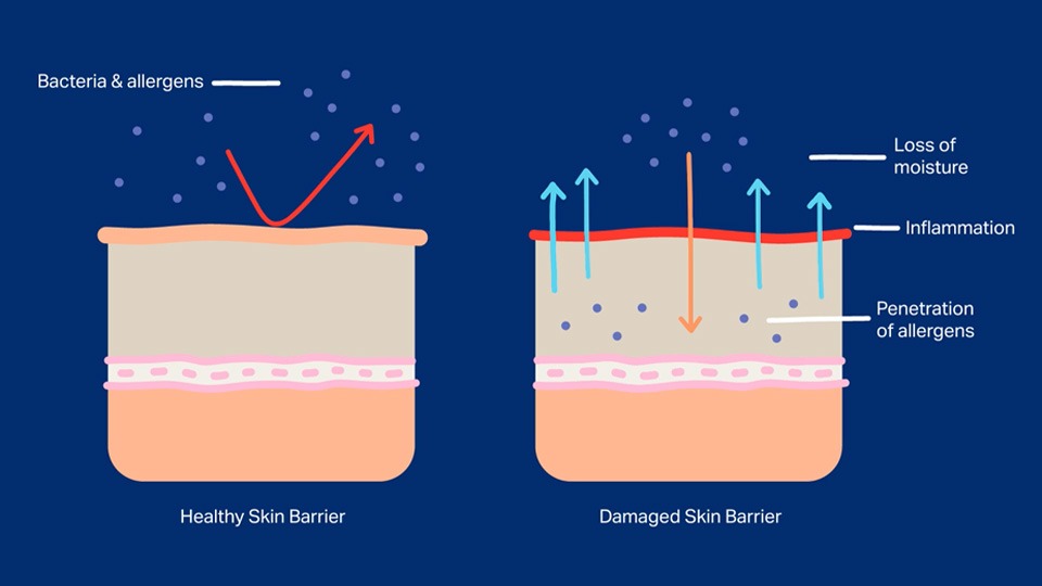 Strengthen Your Skin Barrier: Expert Tips for a Healthy, Radiant Glow