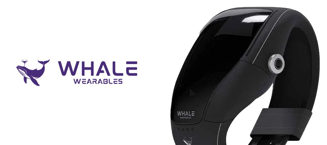 WOW STORY OF THE DAY: Belagavi to Shark Tank: How Whale Wearables Is Redefining Women's Safety One Wearable at a Time.