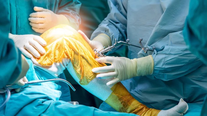 Robotic Knee Replacement Surgery Gains Ground: Myths Debunked, Precision Validated