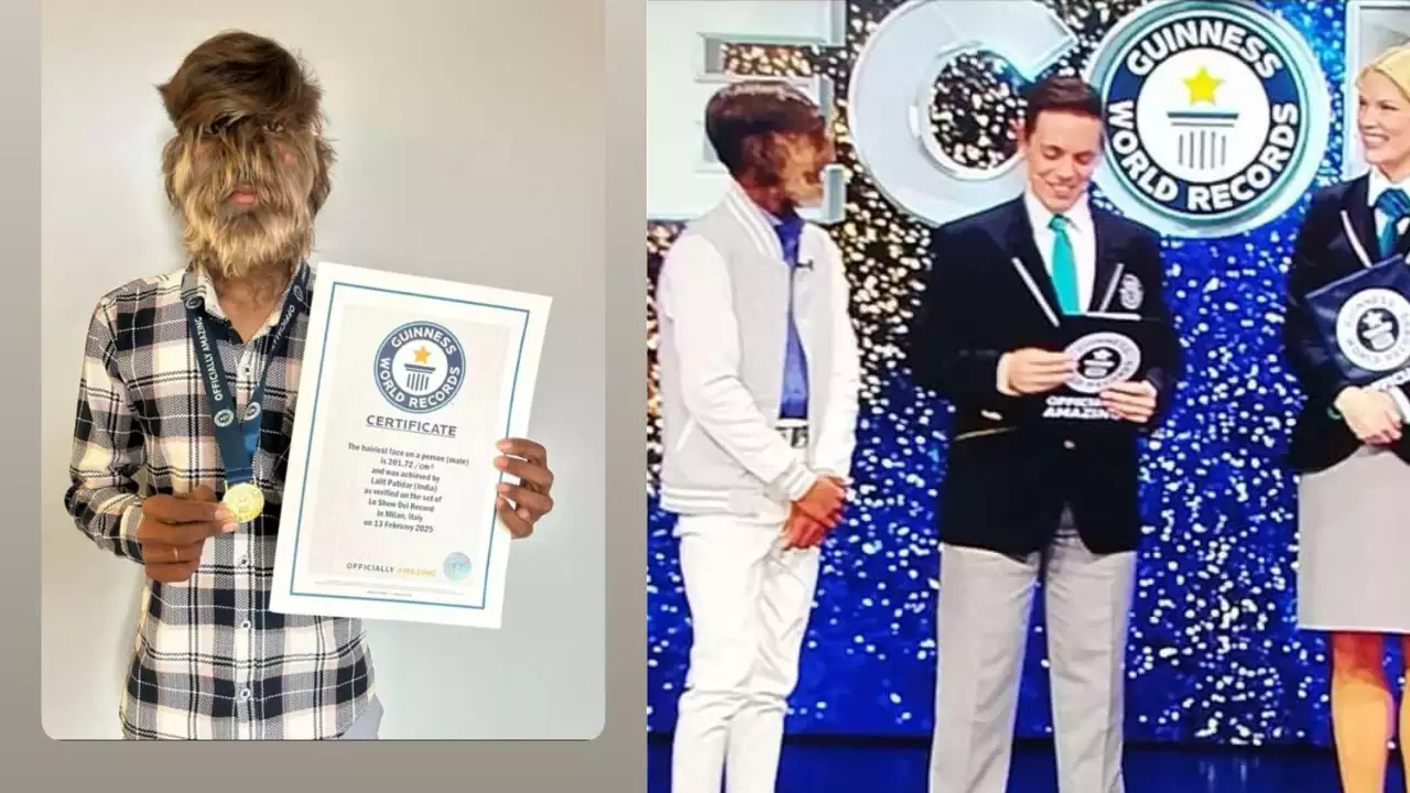 Meet the Indian lad who has turned a rare condition into a record making feat!