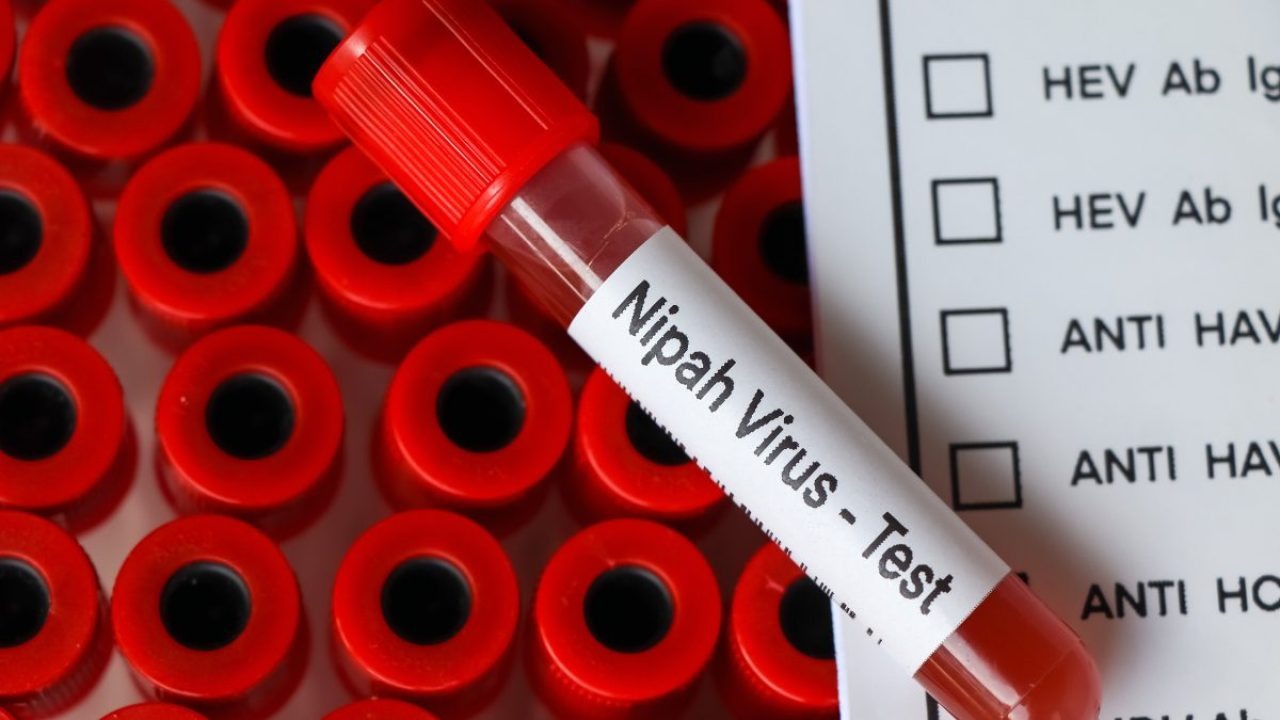 Nipah Virus Update: WHO Confirms Patients Stable, No Spread Detected Among Contacts