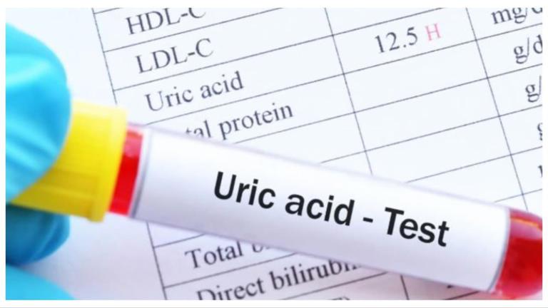 Slice, Soothe, Sustain: 5 Fruits That Keep Uric Acid Levels Cool