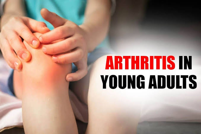 Understanding Early Arthritis Symptoms in Young Adults